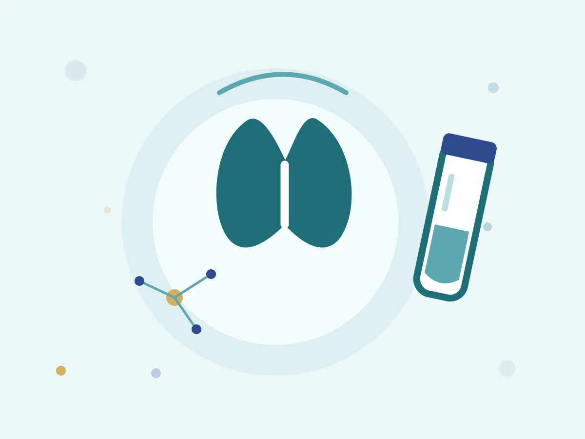 Thyroid illustration